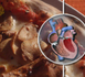 Cholesterol meds raise diabetes risk in women: study