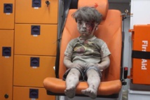 Photo of dazed Syrian boy symbolises Aleppo's plight Photo of dazed Syrian boy symbolises Aleppo's plight