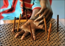 Senegal clinic leads fight to wipe out leprosy Senegal clinic leads fight to wipe out leprosy