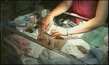 Dying baby's heart may save another baby Dying baby's heart may save another baby