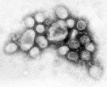 Swine flu spreads as Spain, Uruguay report first deaths Swine flu spreads as Spain, Uruguay report first deaths