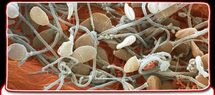 British scientists claim sperm breakthrough British scientists claim sperm breakthrough