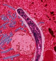 Scientists find malaria jumped from chimps to humans Scientists find malaria jumped from chimps to humans