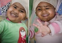 'Fiddly' Australia twin separation surgery passes 24 hours