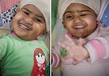 'Fiddly' Australia twin separation surgery passes 24 hours 'Fiddly' Australia twin separation surgery passes 24 hours