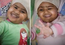 Separated Bangladeshi twin wakes up, looks 'fantastic' Separated Bangladeshi twin wakes up, looks 'fantastic'