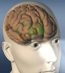 Scientists help stroke victims regain speech through singing Scientists help stroke victims regain speech through singing