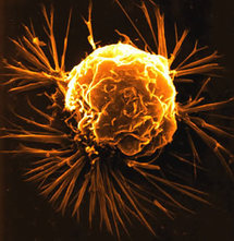 Stem cells point to more resilient cancer: study Stem cells point to more resilient cancer: study