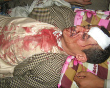46 dead in Yemen protest bloodbath: medics 46 dead in Yemen protest bloodbath: medics