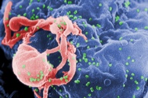 Photo credit: C. Goldsmith. Content Providers: CDC/ C. Goldsmith, P. Feorino, E. L. Palmer, W. R. McManus. Accessed via Wikipedia. Photo credit: C. Goldsmith. Content Providers: CDC/ C. Goldsmith, P. Feorino, E. L. Palmer, W. R. McManus. Accessed via Wikipedia.