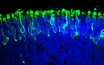 Light ahead in fight against degenerative blindness Light ahead in fight against degenerative blindness