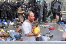 Children separated from families in Hungary border chaos: Amnesty