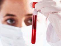 Experimental blood test may find multiple diseases Experimental blood test may find multiple diseases