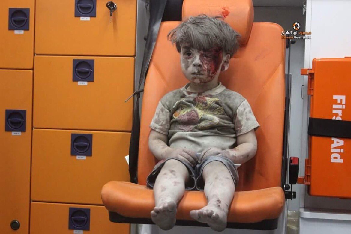 Photo of dazed Syrian boy symbolises Aleppo's plight