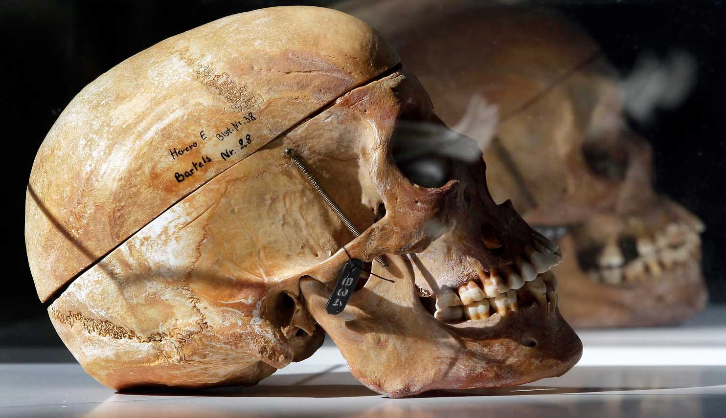Human skulls from Africa investigated by international team in Berlin