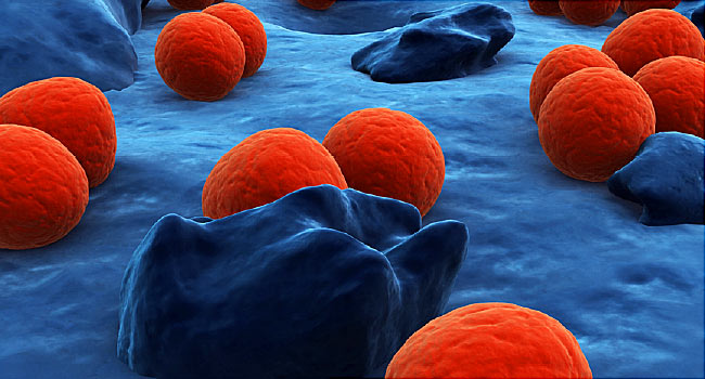 New test is first in US to help detect new STD threat New test is first in US to help detect new STD threat