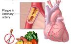 Specialists to review global fight on heart disease
