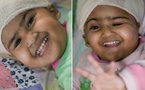 Separated twins beat the odds in remarkable survival story