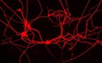Stem cells: 'Huge leap forward,' claim scientists