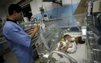 Impossible to separate Gaza-born conjoined twins: doctors