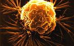 Stem cells point to more resilient cancer: study