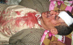 46 dead in Yemen protest bloodbath: medics