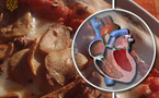 Cholesterol meds raise diabetes risk in women: study