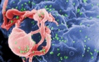 HIV 'cure' in infancy, caution experts