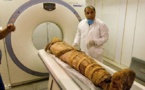 Ancient people also had clogged arteries, mummy scans show