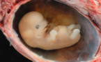 Woman to give birth to own granddaughter in US